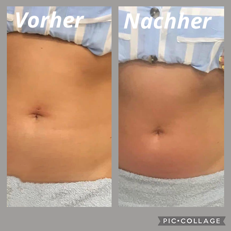 Vorher Nachher Refit Gerat 2