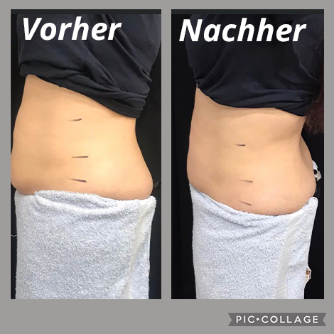 Vorher Nachher Refit Gerat 3