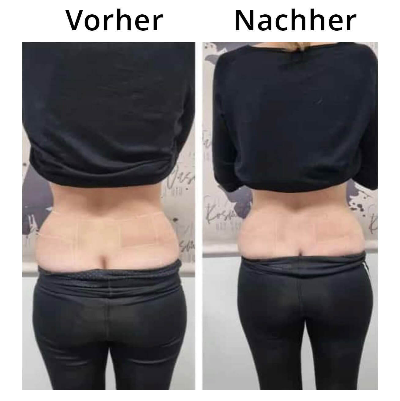 hifu4dErgebnis